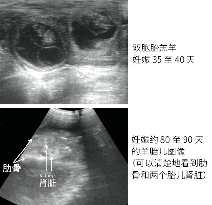 雙胎母羊超聲圖像